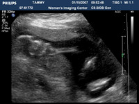 ultrasound pics08