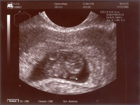 ultrasound pics02