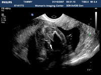 ultrasound pics03