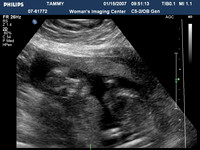 ultrasound pics07