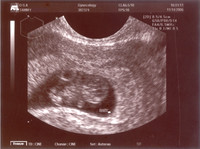 011507 Ultrasound pictures