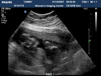 ultrasound pics06
