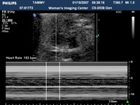 ultrasound pics05