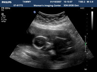 ultrasound pics10