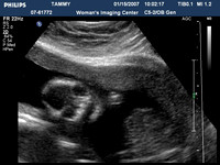 ultrasound pics09