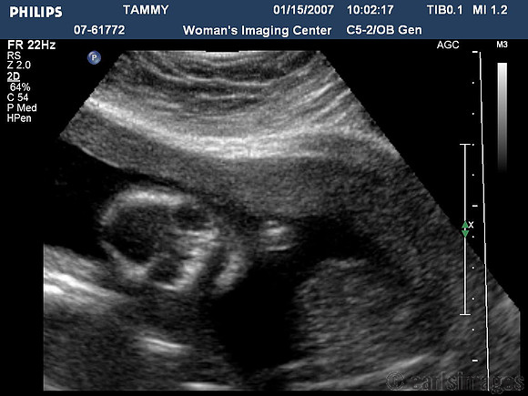 ultrasound pics09