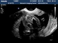 ultrasound pics04